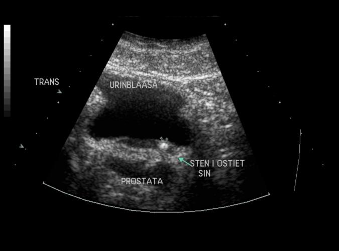 9v av Catherine Olsson, sonograf